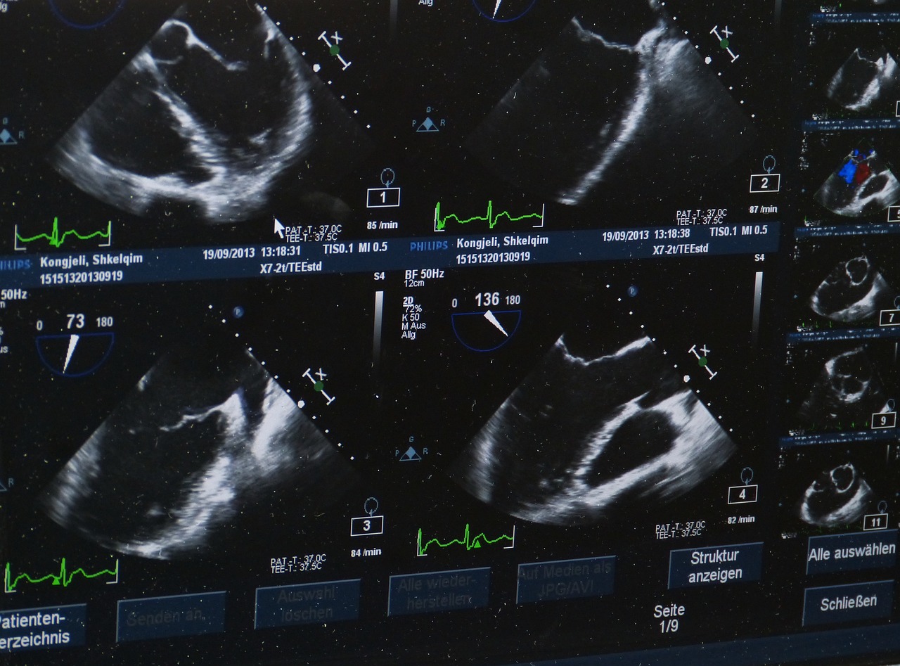 Échographie : en quoi consiste réellement cet examen médical ?